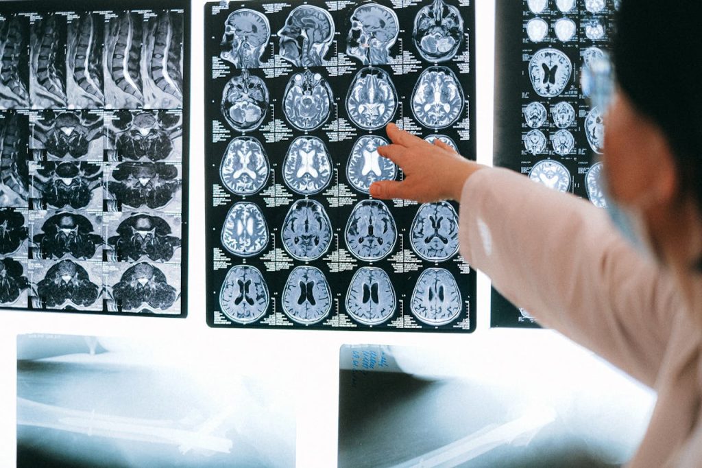 Can Psilocybin Cause Seizures? Photo cover with a doctor pointing at a scan of a brain